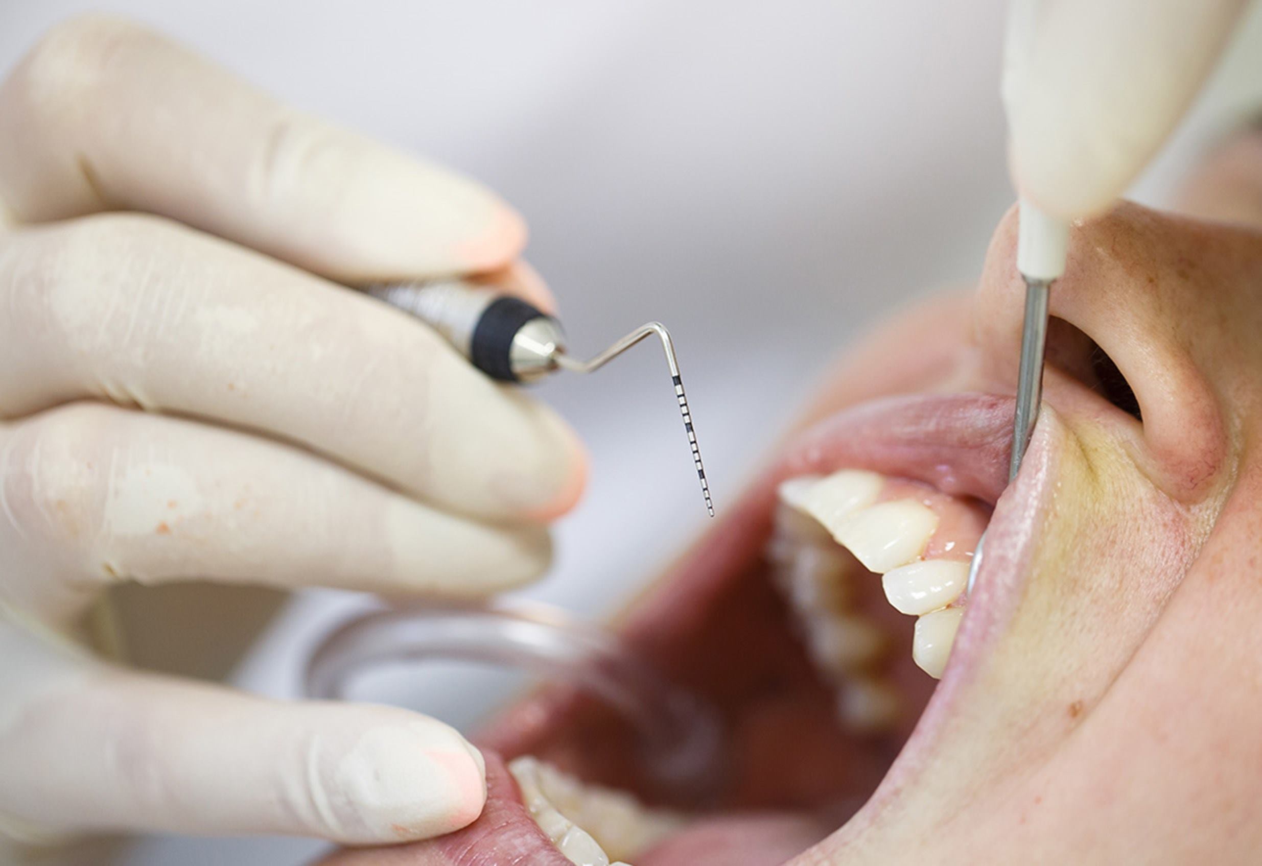 periodoncia-boca-dentista-paciente
