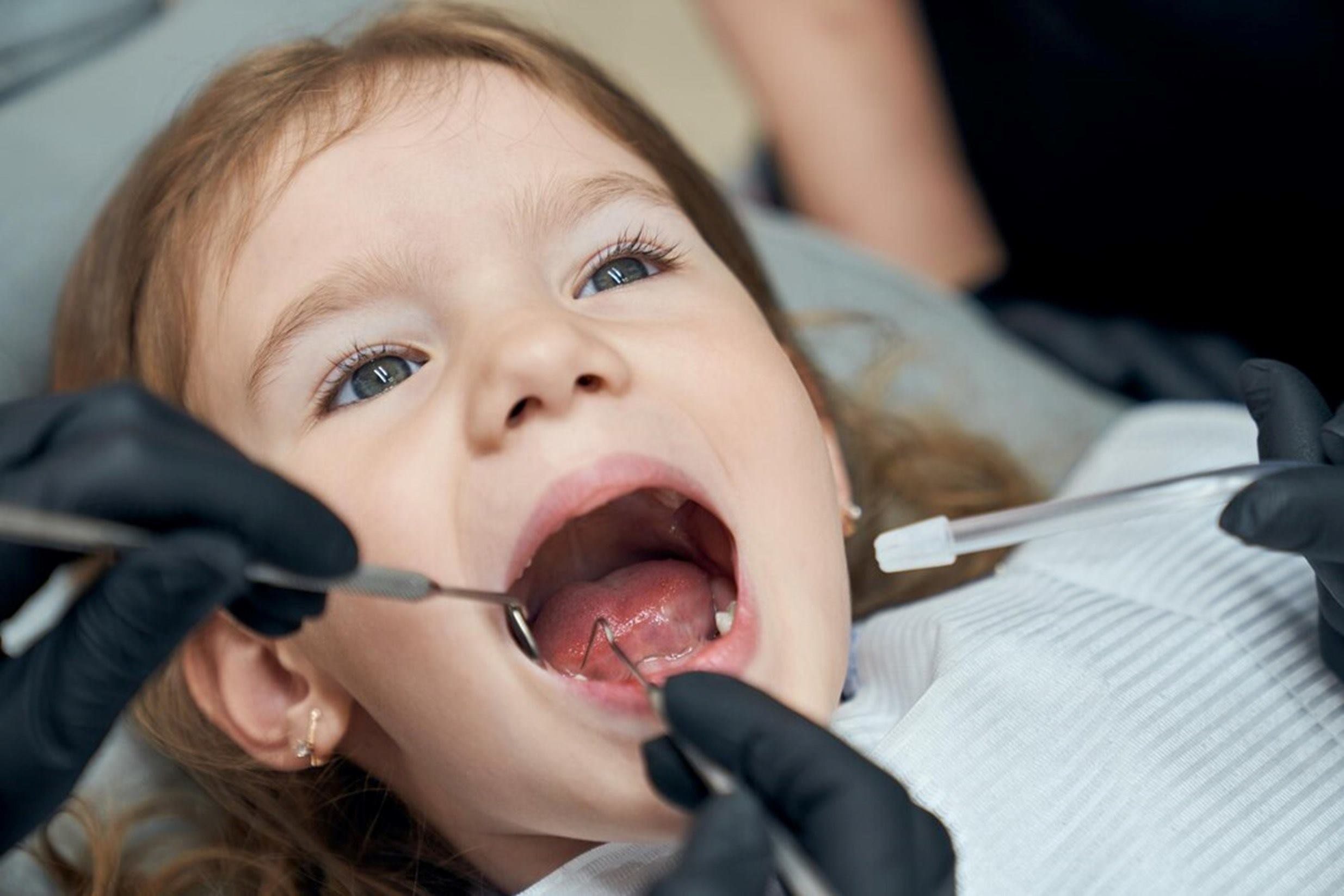 imagen representando odontopediatría en San Sebastian de los Reyes