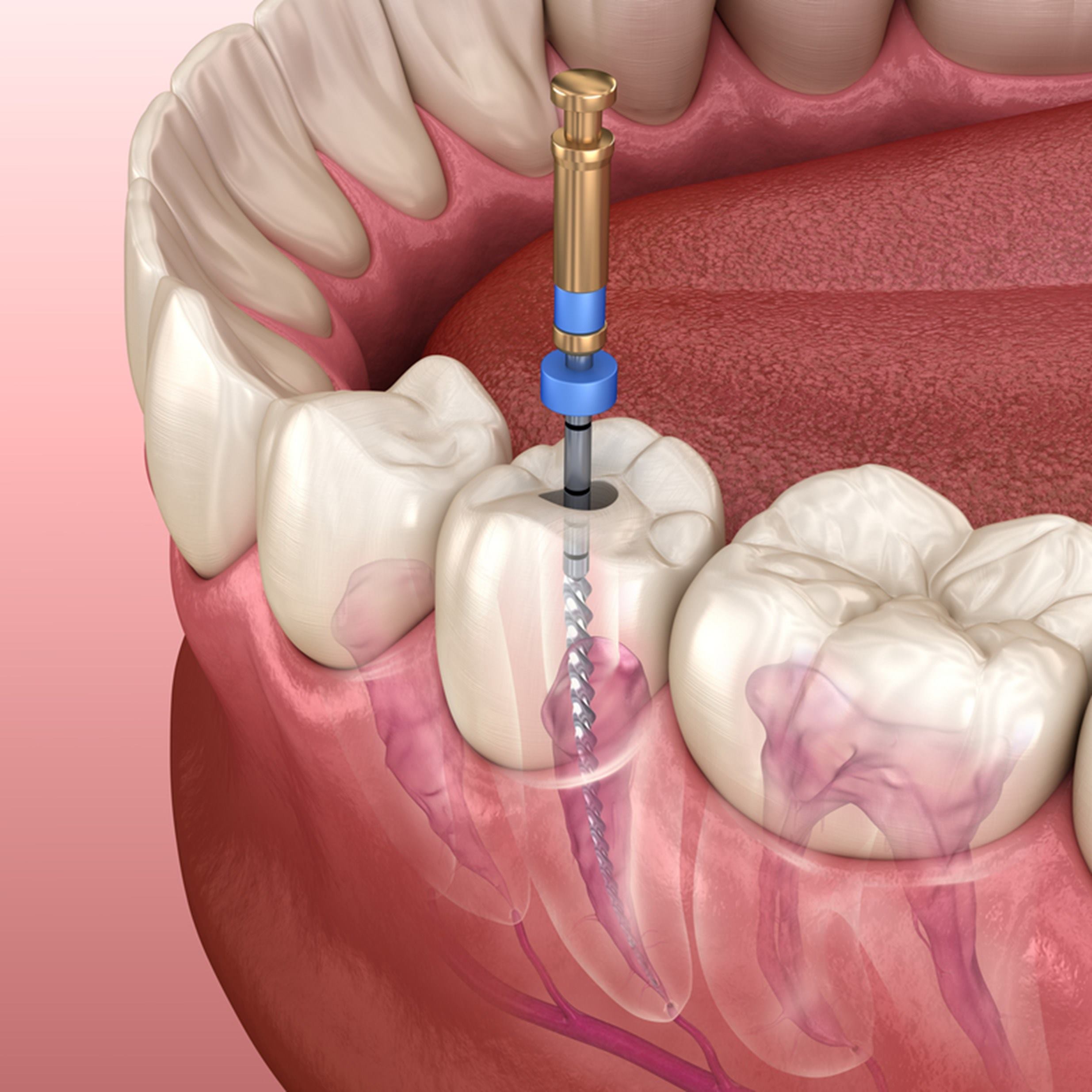boca-dientes-encia-endodoncia
